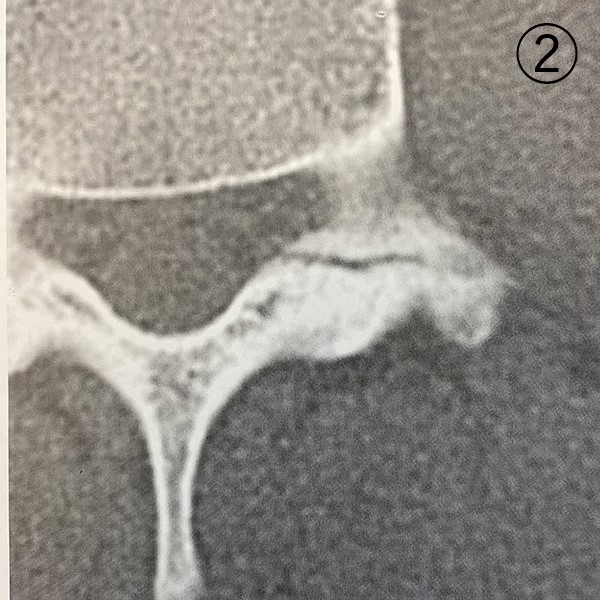 レントゲン写真