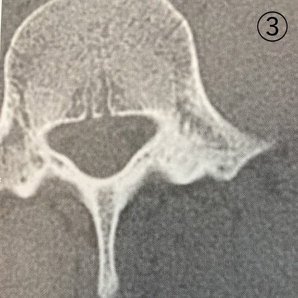 レントゲン写真